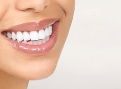 Win A Teeth Whitening Kit worth £450 & Check-up
