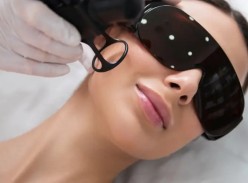 Win a Ultraclear Skin Laser Treatment