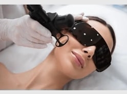 Win a Ultraclear Skin Laser Treatment